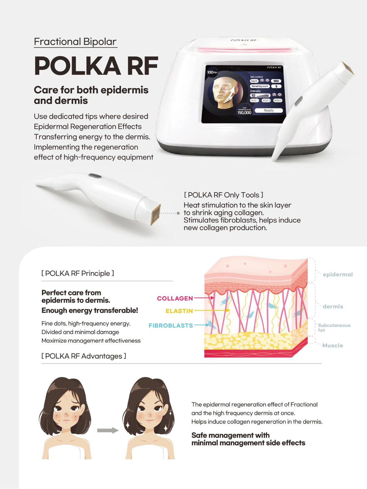 Polka-RF