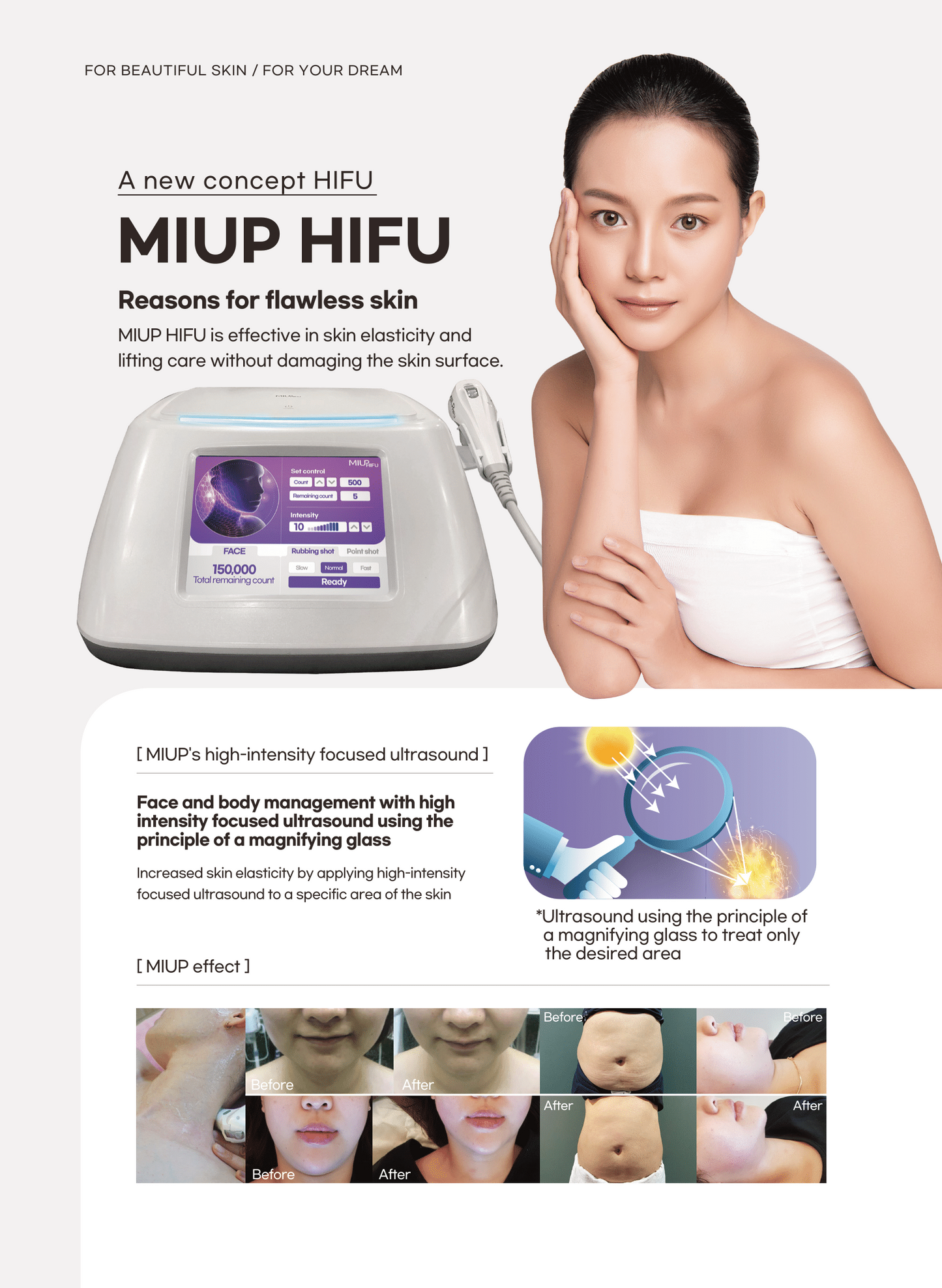 MIUP HIFU