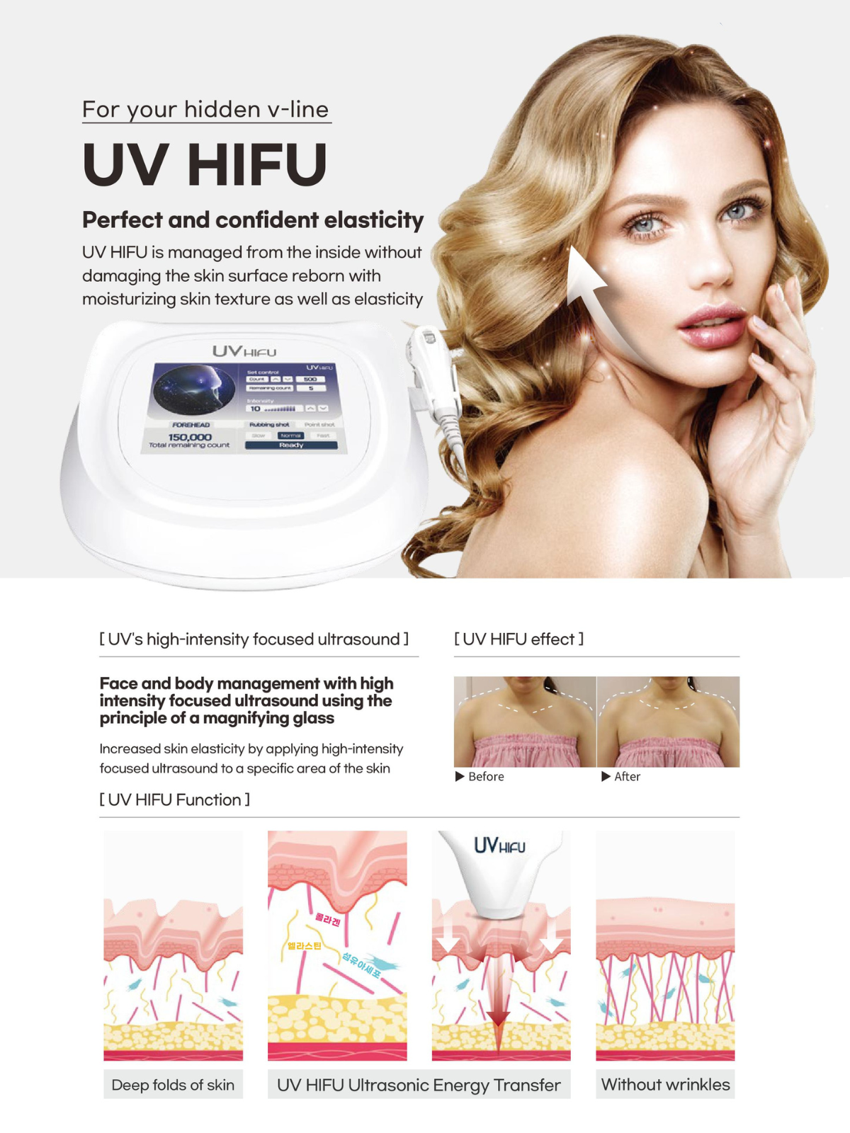 UV HIFU