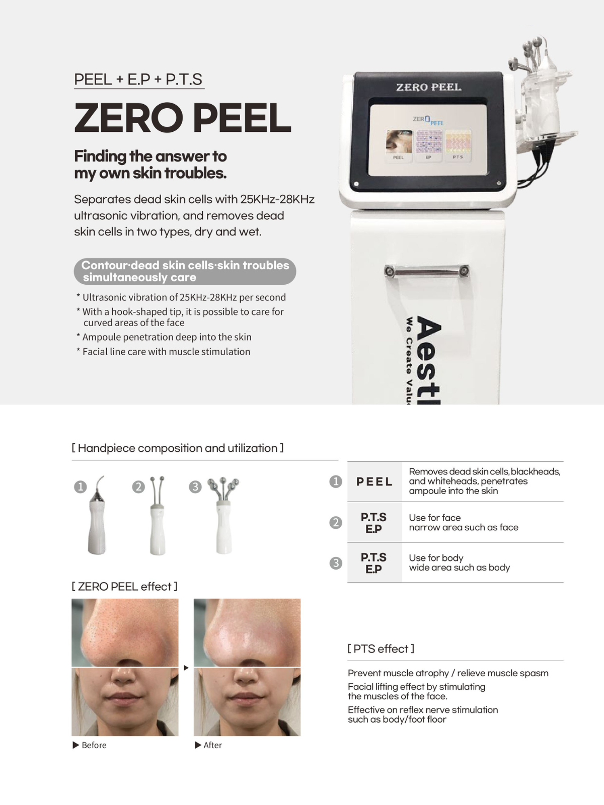 ZERO PEEL